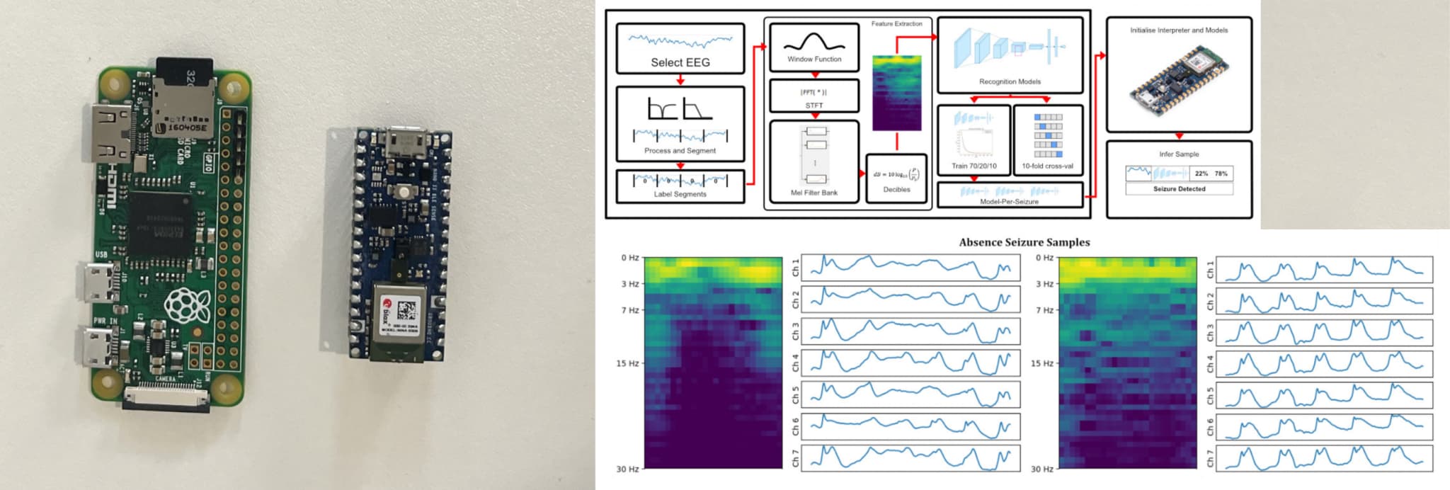 Epileptic seizure detection w/ Tiny Machine Learning